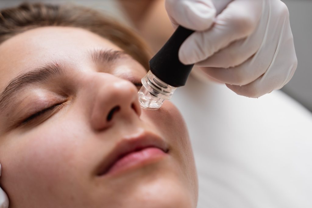 best microneedling results st george